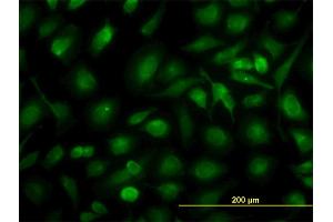 Immunofluorescence of monoclonal antibody to RLBP1 on HeLa cell. (RLBP1 抗体  (AA 1-317))