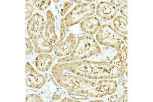 Immunohistochemistry of paraffin-embedded rat kidney using IDH1 Rabbit mAb (ABIN7268027) at dilution of 1:500 (40x lens). (IDH1 抗体)