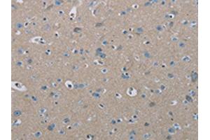 The image on the left is immunohistochemistry of paraffin-embedded Human brain tissue using ABIN7191864(PHKA2 Antibody) at dilution 1/30, on the right is treated with synthetic peptide. (PHKA2 抗体)