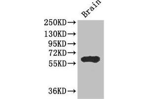 Western Blot Positive WB detected in: Mouse brain tissue All lanes: ICE1 antibody at 2. (ICE1 (AA 1213-1505) 抗体)