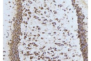ABIN6275540 at 1/100 staining Mouse brain tissue by IHC-P. (TAO Kinase 1 (TAOK1) (Internal Region) 抗体)