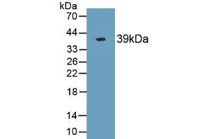 Detection of Recombinant ST2, Human using Monoclonal Antibody to Syntenin 2 (ST2) (SDCBP2 抗体  (AA 1-292))