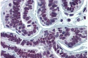 Human Breast: Formalin-Fixed, Paraffin-Embedded (FFPE) (SUMO2 抗体  (AA 1-96))