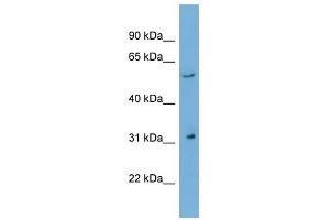 REM1 antibody used at 1 ug/ml to detect target protein. (REM1 抗体)