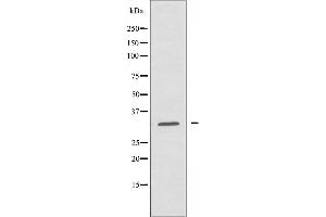 Western blot analysis of extracts from HUVEC cells, using MRPL24 antibody. (MRPL24 抗体  (Internal Region))