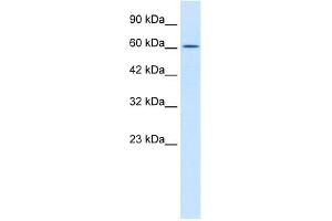 WB Suggested Anti-TRIM17 Antibody Titration:  0. (TRIM17 / RNF16 抗体  (Middle Region))