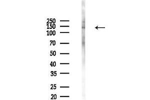 Western blot analysis of lysates from B16F10-LUC cells(heat-shock 45 min treatment), using Phospho-HIPK2 (Thr273) Antibody at 1/1000 dilution.