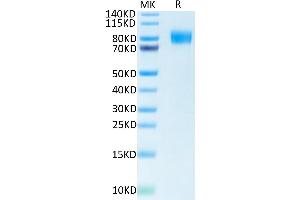 CSF1R Protein (His-Avi Tag,Biotin)