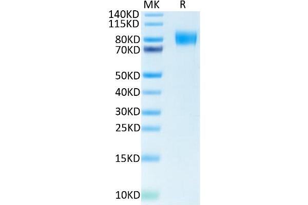 CSF1R Protein (His-Avi Tag,Biotin)