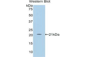 Detection of Recombinant L1CAM, Human using Polyclonal Antibody to L1-Cell Adhesion Molecule (L1CAM) (L1CAM 抗体  (AA 526-690))
