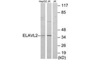 Western blot analysis of extracts from HepG2/Jurkat cells, using ELAVL2 Antibody. (ELAVL2 抗体  (AA 11-60))
