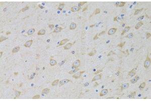Immunohistochemistry (Paraffin-embedded Sections) (IHC (p)) image for anti-Glycyl-tRNA Synthetase (GARS) antibody (ABIN7261389)