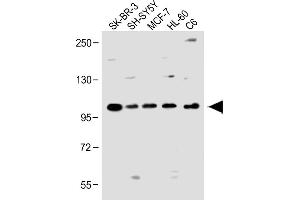 All lanes : Anti-PCDH20 Antibody (Center) at 1:1000 dilution Lane 1: SK-BR-3 whole cell lysate Lane 2: SH-SY5Y whole cell lysate Lane 3: MCF-7 whole cell lysate Lane 4: HL-60 whole cell lysate Lane 5: C6 whole cell lysate Lysates/proteins at 20 μg per lane. (PCDH20 抗体  (AA 445-472))