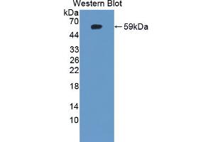 Western blot analysis of the recombinant protein. (IDS 抗体  (AA 107-363))