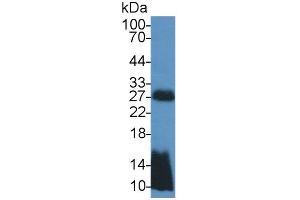 Western Blotting (WB) image for Transmembrane Protein 27 (TMEM27) ELISA Kit (ABIN6720600)