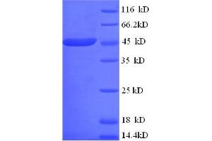 SDS-PAGE (SDS) image for Hepatitis A Virus Cellular Receptor 1 (HAVCR1) (AA 17-397) protein (His tag) (ABIN5708989)