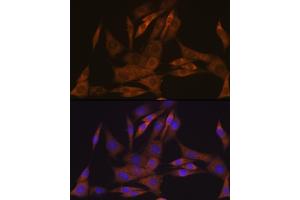 Immunofluorescence analysis of NIH-3T3 cells using KIF Rabbit mAb (ABIN7268120) at dilution of 1:100 (40x lens). (KIFAP3 抗体)