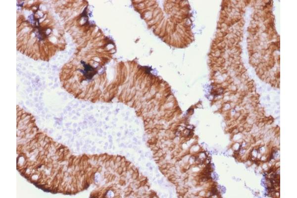 Recombinant EpCAM 抗体  (Extracellular Domain)