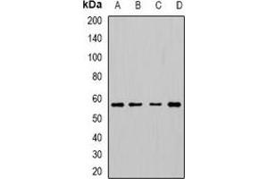 Western blot analysis of Cytochrome P450 3A5 expression in HepG2 (A), SW480 (B), mouse lung (C), mouse thumus (D) whole cell lysates. (CYP3A5 抗体)