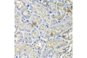 Immunohistochemistry of paraffin-embedded mouse kidney using USH1C antibody (ABIN5972448) at dilution of 1/100 (40x lens). (USH1C 抗体)