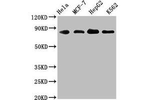 Western Blot Positive WB detected in: Hela whole cell lysate, MCF-7 whole cell lysate, HepG2 whole cell lysate, K562 whole cell lysate All lanes: ARNT antibody at 1. (Recombinant ARNT 抗体)