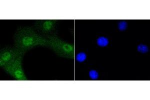 3T3 cells were stained with Akt1(Ser473) (12A1) Monoclonal Antibody  at [1:200] incubated overnight at 4C, followed by secondary antibody incubation, DAPI staining of the nuclei and detection.