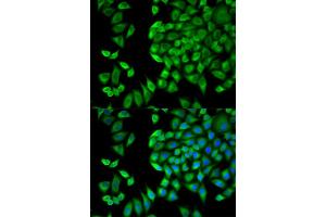 Immunofluorescence analysis of HeLa cells using WNK1 antibody. (WNK1 抗体)