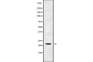 Western blot analysis of TM2D1 using K562 whole cell lysates (TM2D1 抗体  (Internal Region))