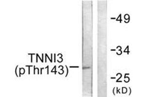 Western blot analysis of extracts from mouse heart, using TNNI3 (Phospho-Thr142) Antibody. (TNNI3 抗体  (pThr142))
