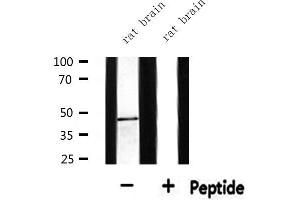 Western blot analysis of extracts from rat brain, using BCKD Antibody. (BCKDK 抗体  (N-Term))