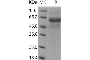 Western Blotting (WB) image for Discoidin Domain Receptor tyrosine Kinase 2 (DDR2) protein (His tag) (ABIN7321116) (DDR2 Protein (His tag))