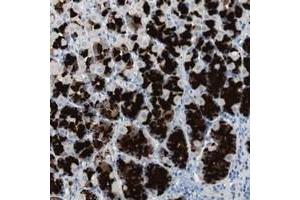 Immunohistochemical staining of human stomach with ULBP1 polyclonal antibody  shows strong cytoplasmic positivity in glandular cells at 1:50-1:200 dilution. (ULBP1 抗体)