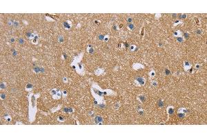 Immunohistochemistry of paraffin-embedded Human brain using BSG Polyclonal Antibody at dilution of 1:60 (CD147 抗体)