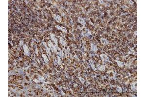 Image no. 2 for anti-Hematopoietic Cell-Specific Lyn Substrate 1 (HCLS1) (AA 266-356) antibody (ABIN598723) (HCLS1 抗体  (AA 266-356))