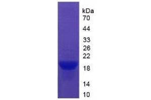 SDS-PAGE of Protein Standard from the Kit (Highly purified E. (Vitronectin ELISA 试剂盒)