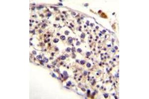Immunohistochemistry (Paraffin-embedded Sections) (IHC (p)) image for anti-HAUS Augmin-Like Complex, Subunit 3 (HAUS3) (AA 379-408), (Middle Region) antibody (ABIN952682)