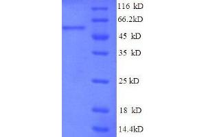 TRAP1 Protein (AA 60-308, partial) (GST tag)