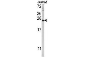 Western blot analysis of TPT1 Antibody (Center) in Jurkat cell line lysates (35ug/lane). (TPT1 抗体  (Middle Region))
