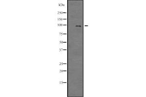 Western blot analysis of E2F7 expression in SP2/0 cell lysate ,The lane on the left is treated with the antigen-specific peptide. (E2F7 抗体)