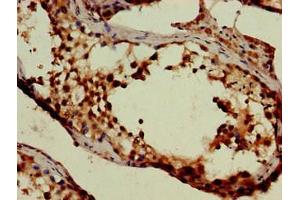 Immunohistochemistry (IHC) image for anti-Solute Carrier Family 6 (Neurotransmitter Transporter, GABA), Member 13 (SLC6A13) (AA 1-40) antibody (ABIN7169952)