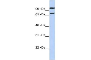 WB Suggested Anti-FAM38B Antibody Titration:  0. (PIEZO2 抗体  (Middle Region))