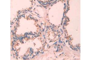 IHC-P analysis of Kidney tissue, with DAB staining. (TCN2 抗体  (AA 19-427))
