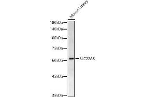 Western Blotting (WB) image for anti-Solute Carrier Family 22 (Organic Anion Transporter), Member 8 (SLC22A8) (C-Term) antibody (ABIN7270419)