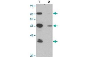 Western blot analysis of TMPO in HeLa cell lysate with TMPO polyclonal antibody  at 0. (Thymopoietin 抗体  (N-Term))