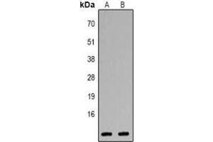 Western blot analysis of CXCL1 expression in Jurkat (A), Hela (B) whole cell lysates. (CXCL1 抗体  (C-Term))