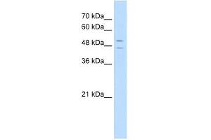 STEAP3 antibody used at 5 ug/ml to detect target protein. (STEAP3 抗体  (N-Term))