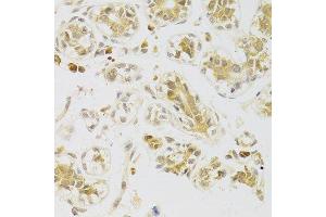 Immunohistochemistry of paraffin-embedded human breast using CASP2 Antibody.