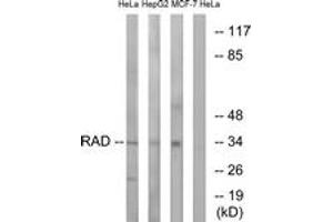Western Blotting (WB) image for anti-Ras-Related Associated with Diabetes (RRAD) (AA 41-90) antibody (ABIN2890366) (RRAD 抗体  (AA 41-90))