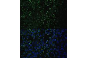 Immunofluorescence analysis of NIH-3T3 cells using  antibody (ABIN6131426, ABIN6136765, ABIN6136766 and ABIN6223405) at dilution of 1:100. (ALDH1A2 抗体  (AA 1-180))