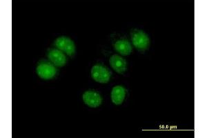 Immunofluorescence of purified MaxPab antibody to ZNF554 on MCF-7 cell. (ZNF554 抗体  (AA 1-538))